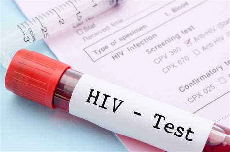 Porn actor unknowingly infected two with HIV after test results。